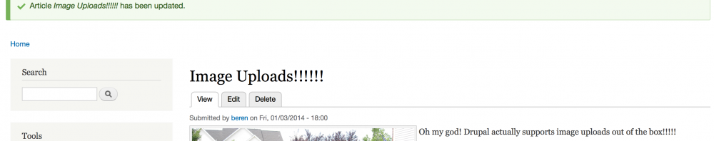 Drupal 8 – Progress – Image Uploads