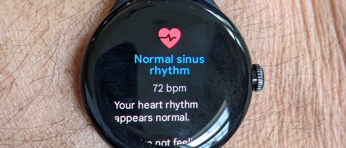 Google watch Fitbit Integration