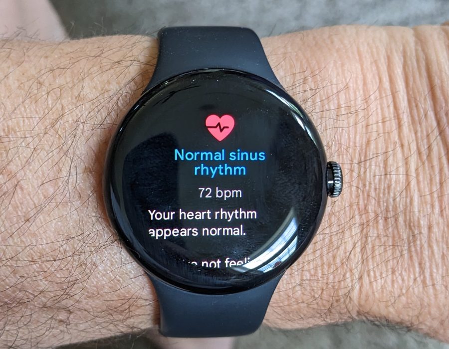 Google watch Fitbit Integration